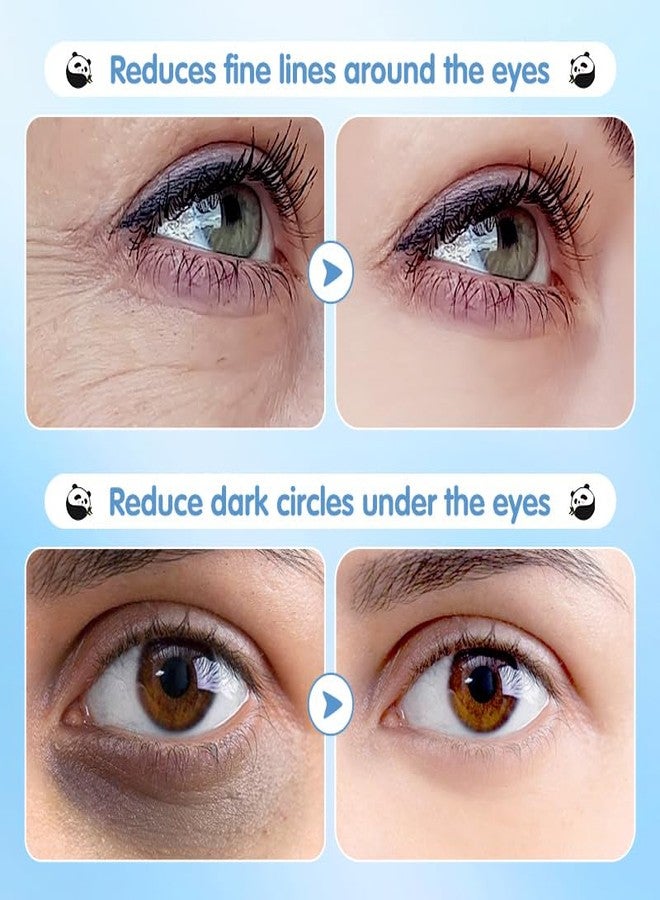 Epstur Under Eye Patches for Dark Circles, Puffy Eyes & Wrinkles - 60 Pairs Hydrating Eye Mask with Hyaluronic Acid, Blueberry Extract - Vegan, Cruelty-Free - Image 3